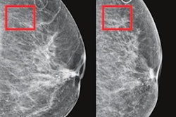 2021 01 29 22 49 1245 2021 02 01 Ai Mammo 20210127215620