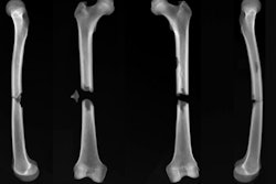 2021 02 01 21 53 7440 2021 02 02 Cambridge Bones Fig7 400
