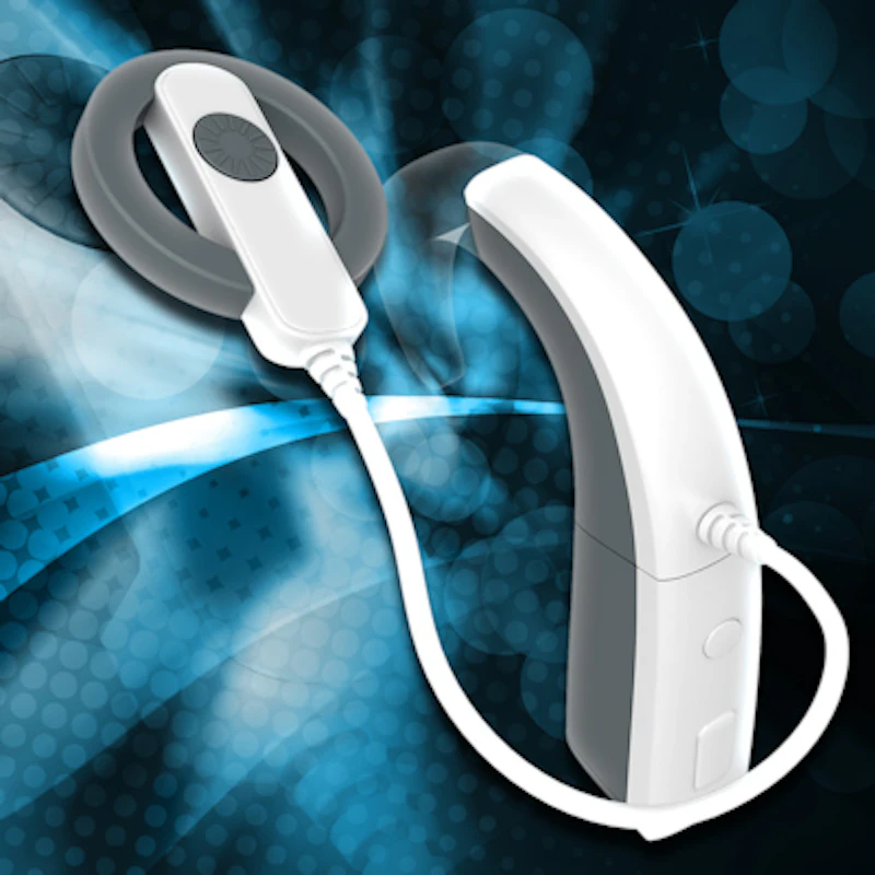 Cochlear Mri Splint Cochlear implant vendor makes MRI safety pledge | AuntMinnieEurope