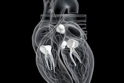 2021 02 09 18 17 2157 Heart Valves 3 D 400