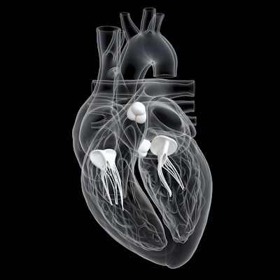 2021 02 09 18 17 2157 Heart Valves 3 D 400