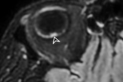 2021 02 12 22 37 2459 2021 02 16 Mri Covid Eye Complications Figure2 B 20210212225315