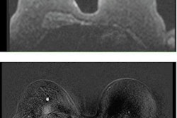 2021 02 16 20 04 6036 2021 02 18 Mr Mammography Examples 20210216200605