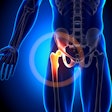2021 02 18 23 25 2941 Hip Joint 400