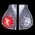 2021 03 03 18 05 9544 X Ray Mammogram Mediolateral 400