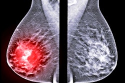 2021 03 03 18 05 9544 X Ray Mammogram Mediolateral 400