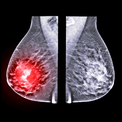 2021 03 03 18 05 9544 X Ray Mammogram Mediolateral 400