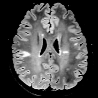 2021 03 05 00 37 5735 2021 03 05 Ecr 2021 Mri Ms Protocol Barkhof