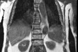 2021 03 08 17 23 3554 2021 03 08 Lecouvet Wb Mri Metastatic Prostate 20210308174431
