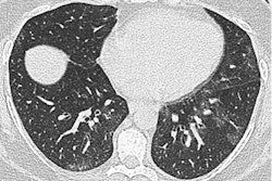 2021 03 08 18 28 4332 2021 03 08 Copley Obesity Fig 2 Image A