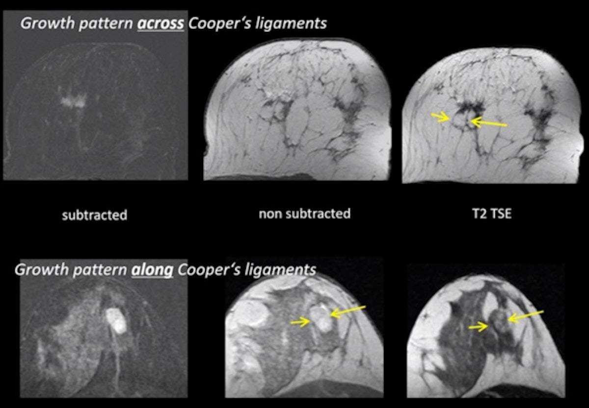 Kuhl provides master class on breast MRI at ECR 2021