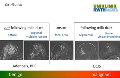 Ask yourself: Does distribution follow the milk ducts?