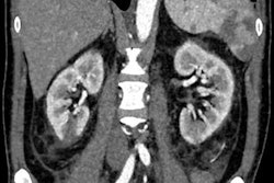 2021 03 11 17 45 5637 2021 03 11 Ecr Renal Covid Image1 20210311171748