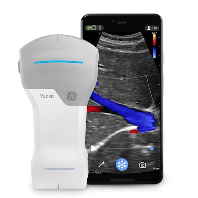 GE's new Vscan Air compact ultrasound unit. All images and video clips courtesy of GE.