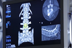 2021 03 16 19 30 0660 2020 03 16 7 D Surgical 400