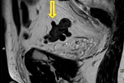 2021 03 22 16 47 5512 2021 03 22 Mri Insider Diverticular Disease 20210322161822