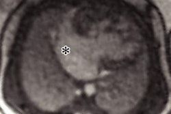 2021 03 30 20 02 9302 2021 03 30 Jama Figure4 20210330205306