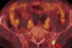 2021 04 01 15 30 4321 2021 04 01 Blue Earth Image F