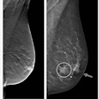 2021 04 07 17 03 5825 2021 04 06 Radiology Dbt Version2 400