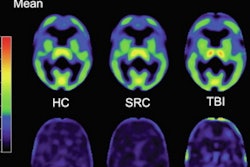 2021 04 20 20 11 9922 2021 04 21 Pet Tracer Imaging 400