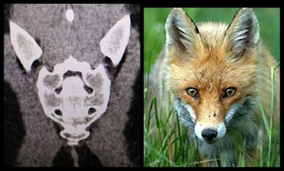 Sacral fox. Pelvic CT (coronal) of sacral bone and ilium looks like a fox.