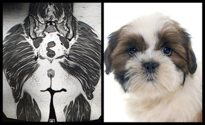 Gluteal dog. Pelvic MRI (coronal) of gluteal muscles looks like a dog.