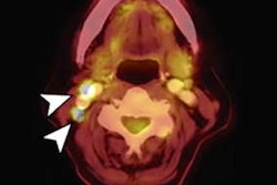 2021 04 30 14 51 9736 2021 04 30 Fused Pet Ct Image A 400