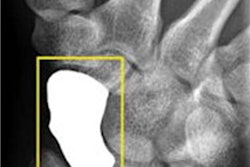 2021 05 03 15 30 9114 2021 04 28 Ai Wrist Fracture 20210427230942