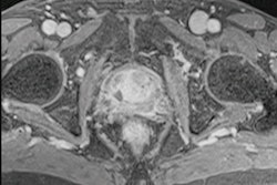 2021 05 04 16 16 5818 2021 05 04 Mri Insider Figure 6f 400