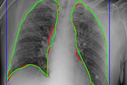 2021 05 18 16 52 5719 2021 05 18 Bracco Ai For Covid