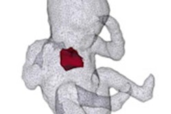 2021 05 26 23 12 9212 2021 05 28 Med Phys Ai Fetus 20210526235556
