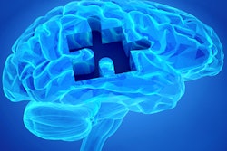 2019 11 05 22 32 2296 Brain Puzzle Dementia 400