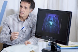 2021 03 15 18 14 1275 Mri Prostate 400