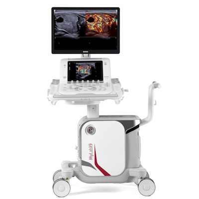 Esaote's new MyLab X75 ultrasound scanner. Image courtesy of Esaote.