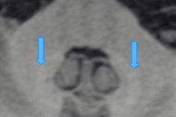 2021 06 01 17 07 5150 2021 06 02 Radbuch Clinical Image 20210601175258