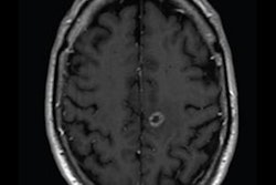 2021 06 21 15 08 7035 2021 06 17 Reduced Dose Brain Mri 400