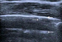 2021 06 21 21 53 4994 2021 06 22 Esr Statement Ultrasonography Figure7 20210621214745