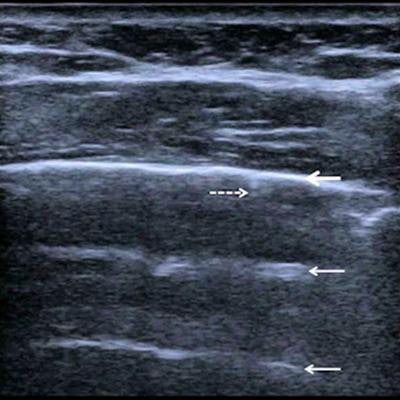 2021 06 21 21 53 4994 2021 06 22 Esr Statement Ultrasonography Figure7 20210621214745