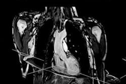 2021 06 30 16 42 0879 2021 06 30 Philips 3d Cmr 20210630163543