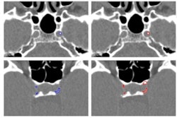 2021 07 01 19 39 3669 2021 07 01 Radiology Ai Bortsova Figure5 400