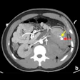 2021 07 20 01 54 9742 2021 07 20 Renal Complications Fig12b 400