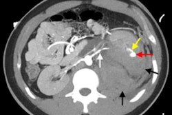 2021 07 20 01 54 9742 2021 07 20 Renal Complications Fig12b 400