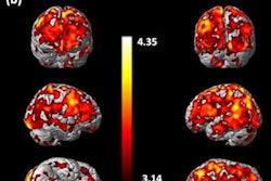 2021 07 22 18 03 4004 2021 07 26 C 11 Bu99008 Brains 20210722183323