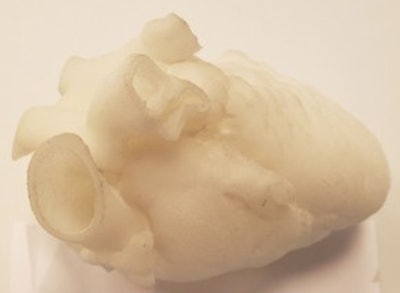 3D printed infant heart model manufactured by Shapeways for Armor Bionics. Image courtesy of Shapeway.