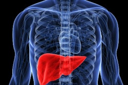 2021 07 30 18 11 8781 Man Liver 400