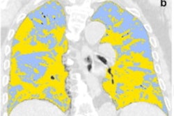 2021 07 30 23 36 5589 2021 07 28 Radiology Caruso Figure4 Image B