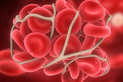 2021 08 09 18 25 7448 Blood Clot 400