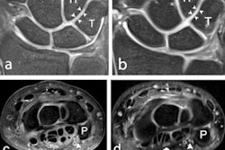 2021 08 19 22 08 6656 2021 08 23 7t Wrist Mri Study Figure3 400