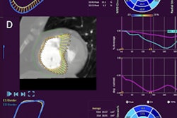 2021 08 26 15 31 1213 2021 08 26 Esc 2021 Strain Ct 400