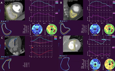 2021 08 26 15 31 1369 2021 08 26 Esc 2021 Strain Ct 1000